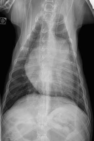 Figure 2 : Radiographie de thorax en décubitus ventro-dorsal